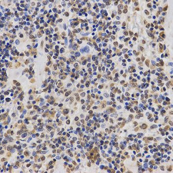 Immunohistochemistry - TriMethyl-Histone H3-K36 pAb (144-02366)