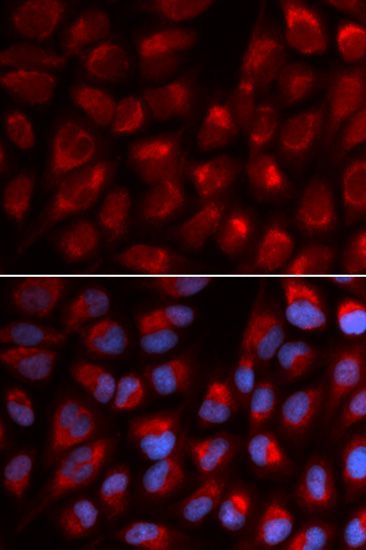 Immunofluorescence - EPB41 antibody (144-02490)