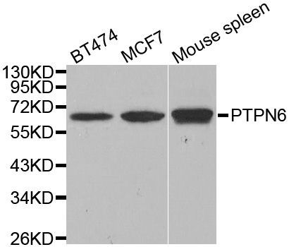 Western blot - PTPN6 antibody (144-01446)