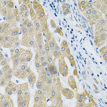 Immunohistochemistry - ALG2 Antibody (144-07843)