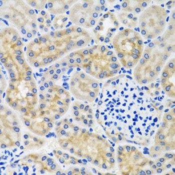 Immunohistochemistry - ANTXR2 antibody (144-06526)