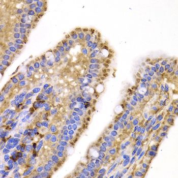 Immunohistochemistry - SMYD4 Polyclonal Antibody (144-07310)