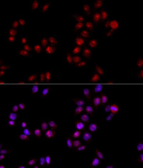 Immunohistochemistry - HMGB1 Polyclonal Antibody (144-02553)