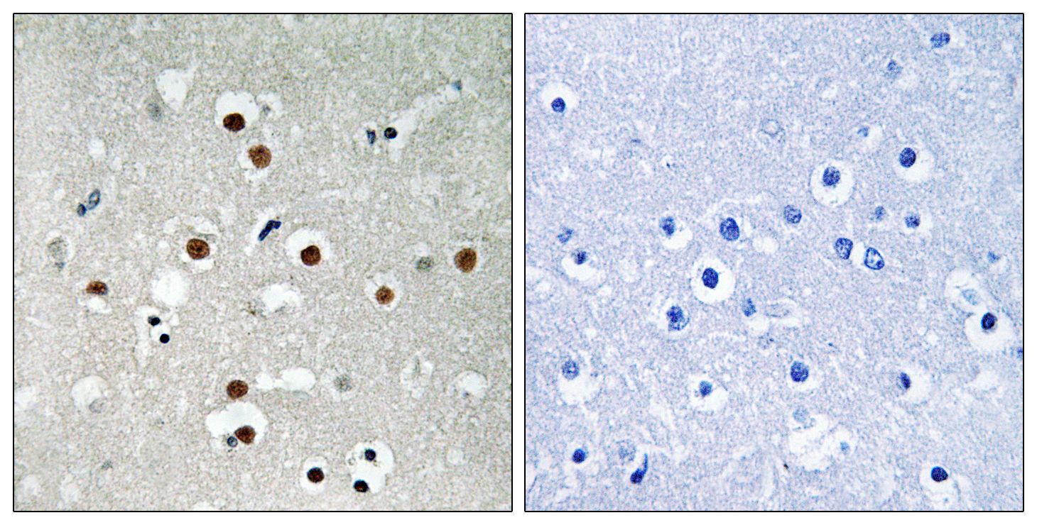 IHC