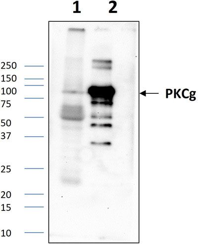 Western blot