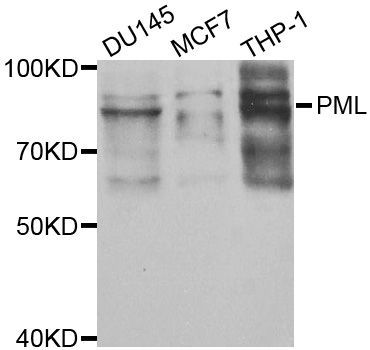 Western blot - [KO Validated] PML Polyclonal Antibody (144-01184)