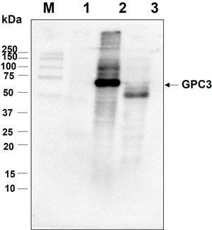 Western blot