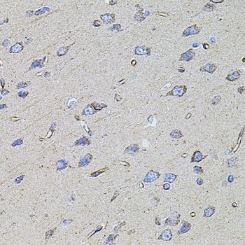 Immunohistochemistry - FLNB Polyclonal Antibody (144-02481)