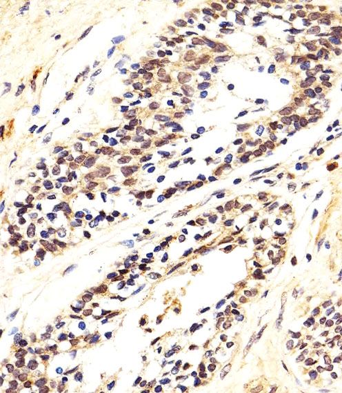IHC-P