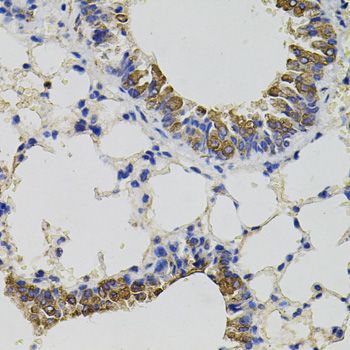 Immunohistochemistry - CD59 antibody (144-01689)