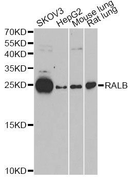Western blot - RALB antibody (144-61378)