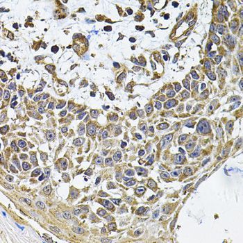 Immunohistochemistry - ICOSLG Polyclonal Antibody (144-07080)