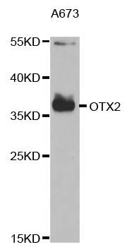 Western blot - OTX2 antibody (144-05475)