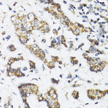 Immunohistochemistry - DHRS2 antibody (144-06446)