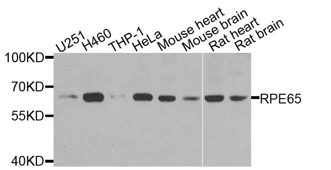 Western blot - RPE65 antibody (144-09841)