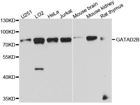 Western blot - GATAD2B antibody (144-09716)