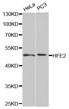 Western blot - HFE2 antibody (144-05348)