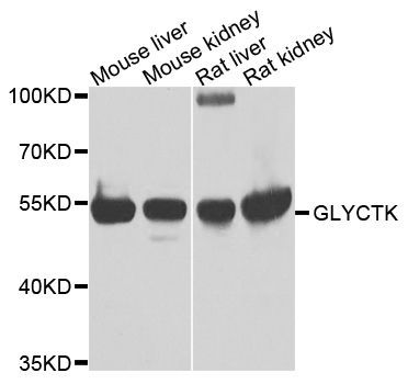 Western blot - GLYCTK antibody (144-07852)