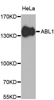 Western blot - ABL1 Polyclonal Antibody (144-00282)