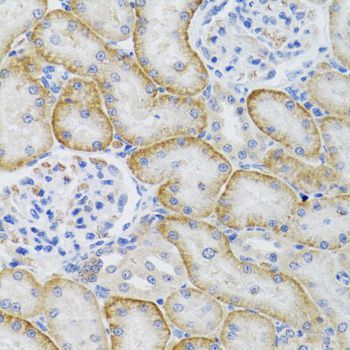 Immunohistochemistry - ARFGAP1 Polyclonal Antibody (144-07118)