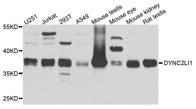 Western blot - DYNC2LI1 antibody (144-04752)