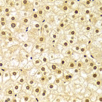 Immunohistochemistry - Lamin A/C Polyclonal Antibody (144-00249)