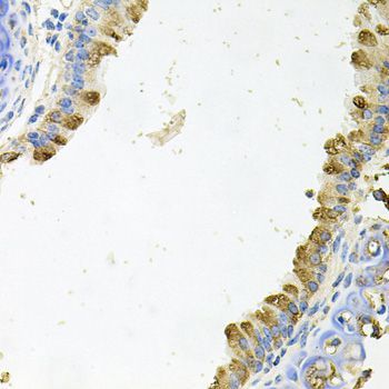 Immunohistochemistry - KLK11 antibody (144-06641)