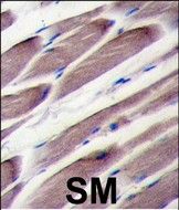 IHC-P