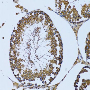 Immunohistochemistry - EIF2AK4 antibody (144-12618)
