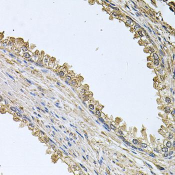 Immunohistochemistry - MEMO1 antibody (144-08582)