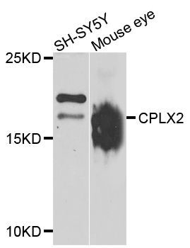 Western blot - CPLX2 antibody (144-07774)