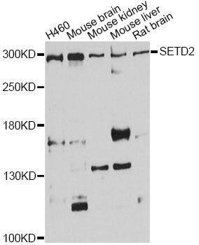 Western blot - SETD2 Polyclonal Antibody (144-03194)