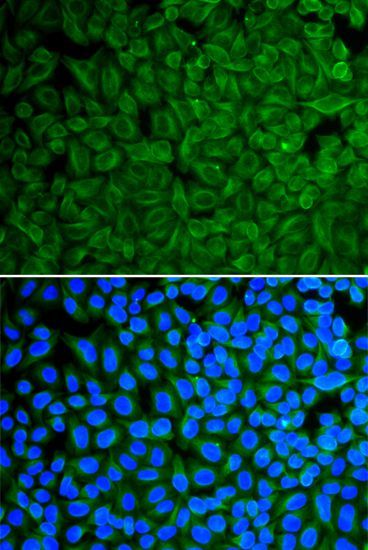 Immunofluorescence - GAD2 Polyclonal Antibody (144-00971)