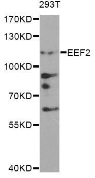 Western blot - EEF2 Polyclonal Antibody (144-60005)