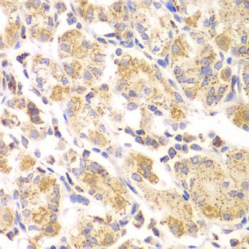 Immunohistochemistry - EYA3 Polyclonal Antibody (144-07893)