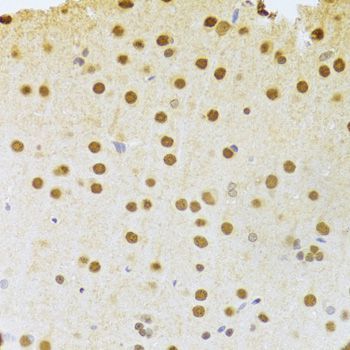 Immunohistochemistry - ANP32A Antibody (144-05768)