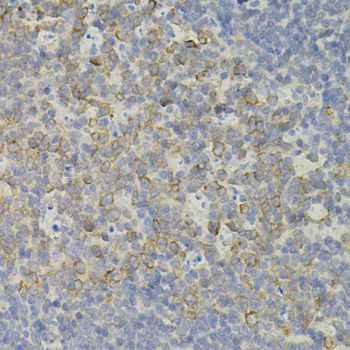 Immunohistochemistry - IRF1 Polyclonal Antibody (144-07692)