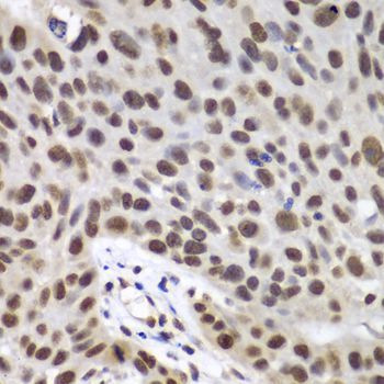Immunohistochemistry - DDX5 antibody (144-60268)