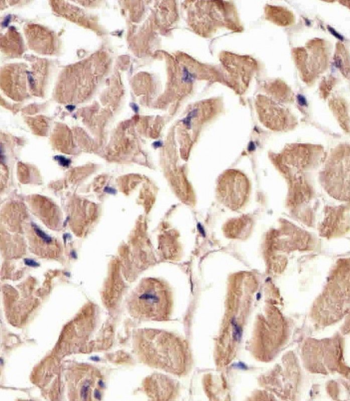 IHC-P