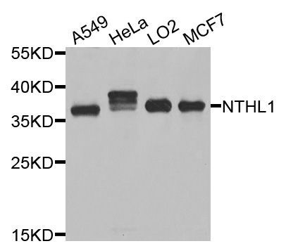 Western blot - NTHL1 Polyclonal Antibody (144-06820)