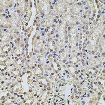 Immunohistochemistry - SMARCC2 antibody (144-01967)