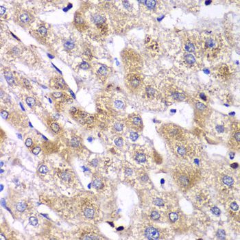 Immunohistochemistry - RPS10 antibody (144-06056)
