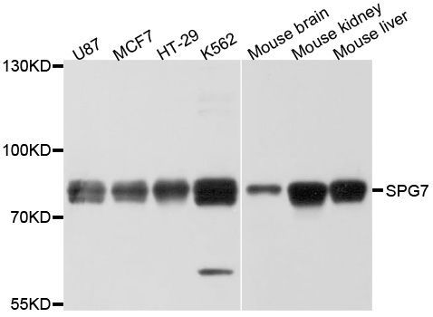 Western blot - SPG7 Polyclonal Antibody (144-010249)