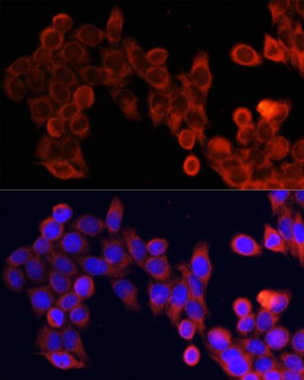 Immunofluorescence - mTOR Polyclonal Antibody (144-02445)