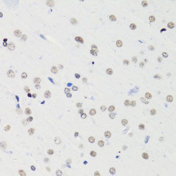 Immunohistochemistry - Acetyl-Histone H4-K5 pAb (144-60957)