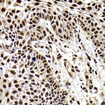 Immunohistochemistry - HIRIP3 antibody (144-07014)