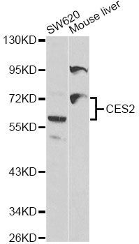 Western blot - CES2 antibody (144-01514)
