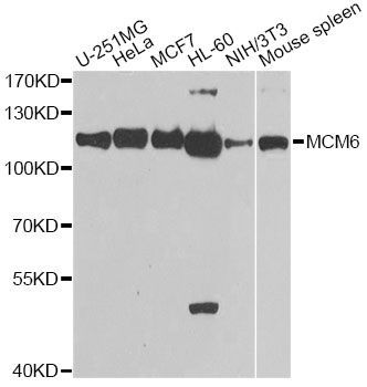 Western blot - MCM6 antibody (144-01955)