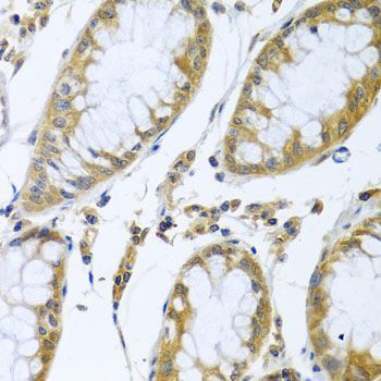 Immunohistochemistry - FBXL5 antibody (144-05602)