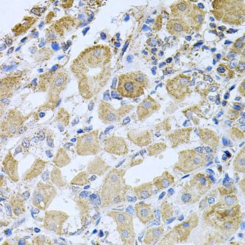 Immunohistochemistry - BCR Polyclonal Antibody (144-00068)